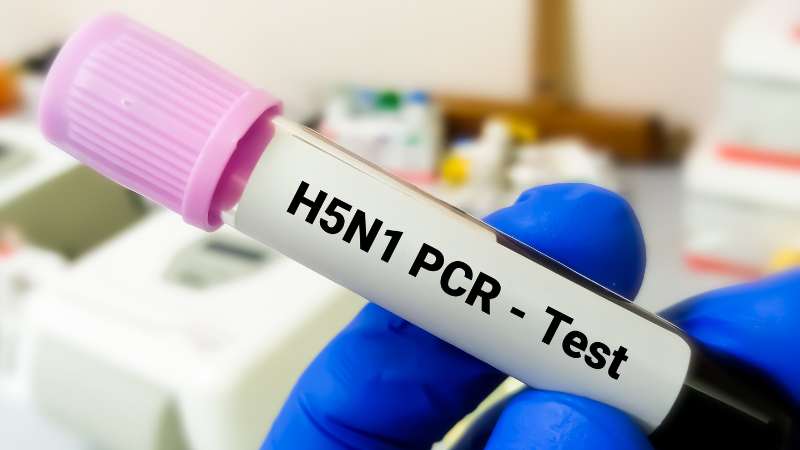 pcr test